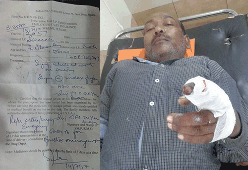 ESIC Mohali Row: Another insured worker loses finger due to unavailability of services at ESIC hospital